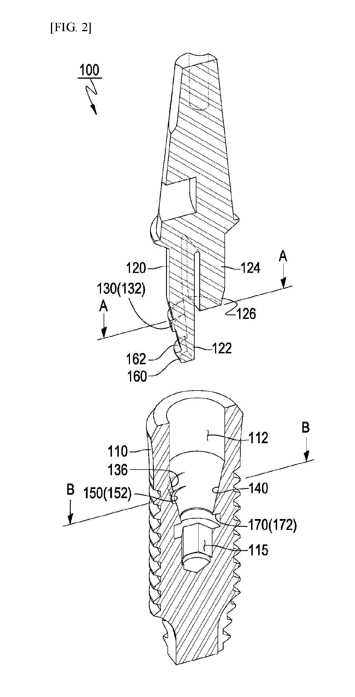 Dental implant