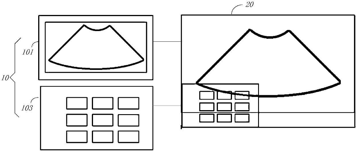 Video output method and system of ultrasound diagnostic equipment