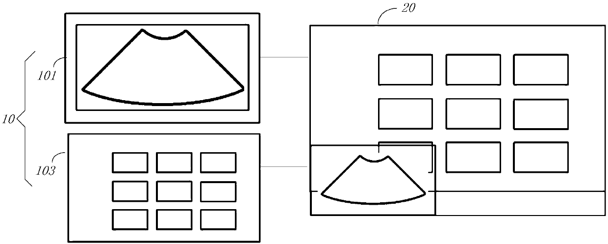 Video output method and system of ultrasound diagnostic equipment