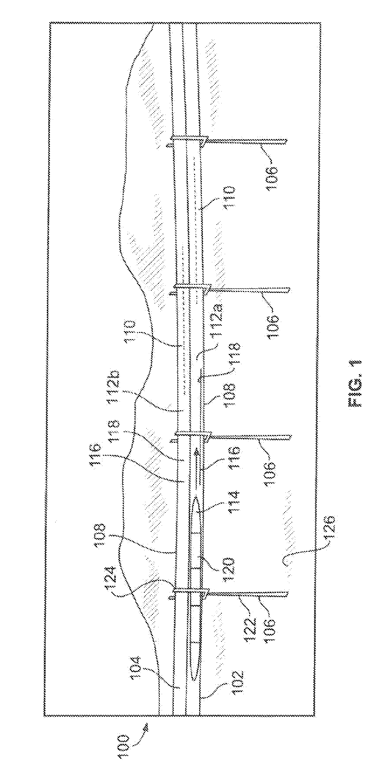 Support systems and methods for a transportation system