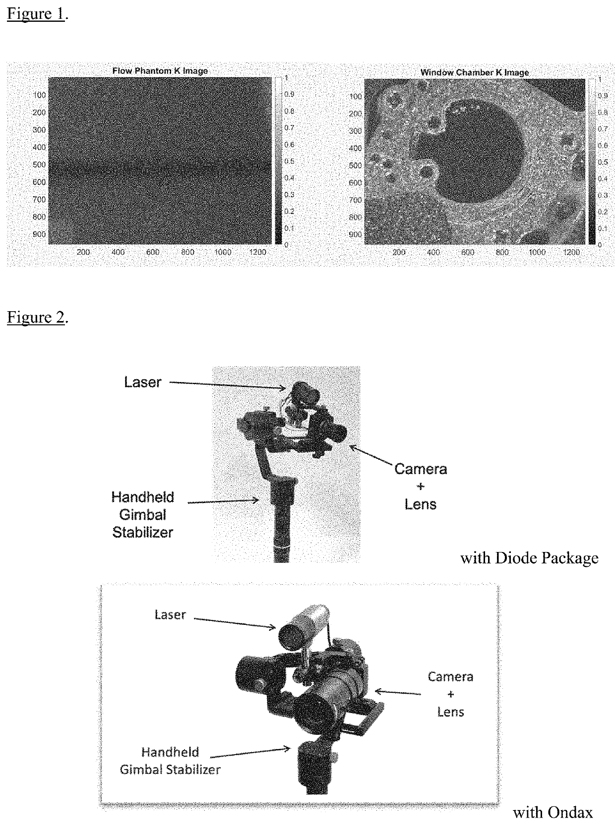 Motion stabilized laser speckle imaging