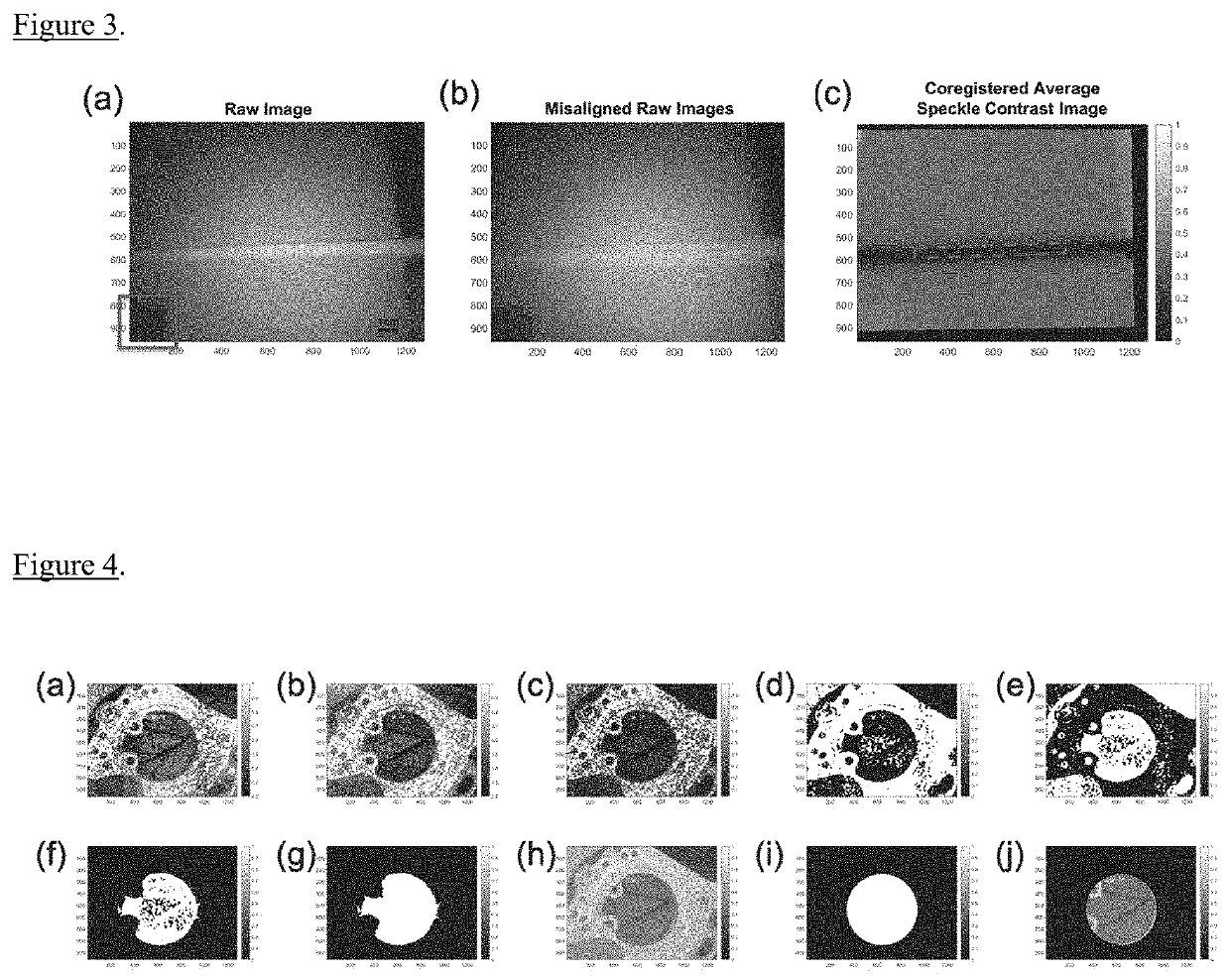 Motion stabilized laser speckle imaging