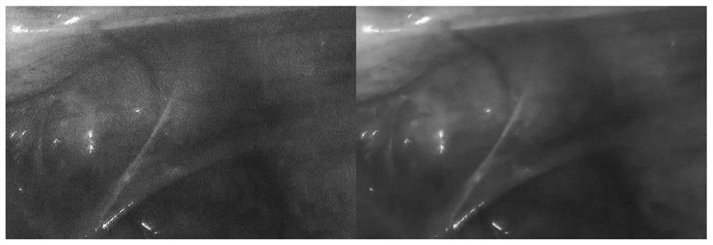 Medical endoscopic image denoising method based on CBD-Net