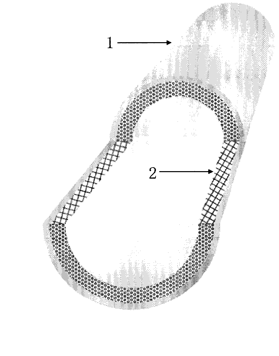 High-strength, high-elasticity and degradable artificial cardiovascular stent and preparation method thereof