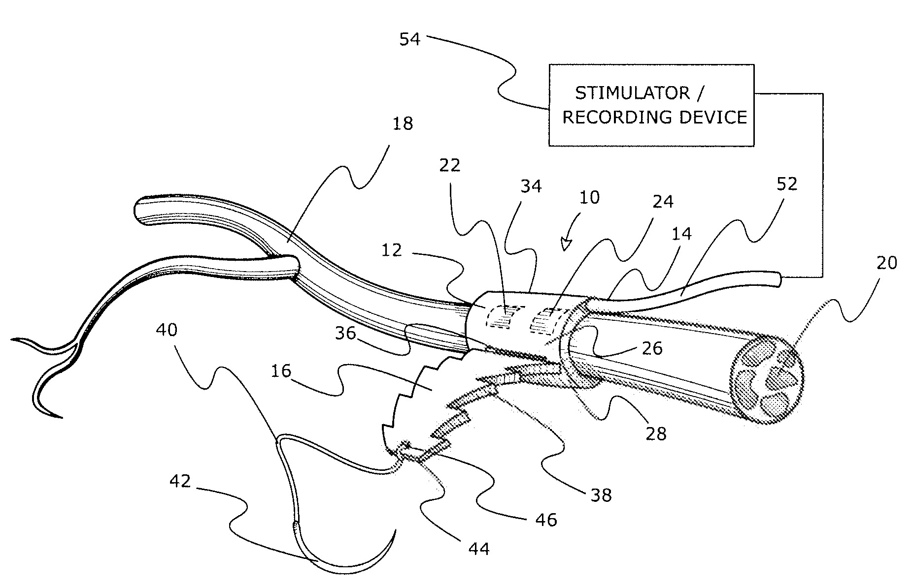 Adjustable tissue or nerve cuff and method of use