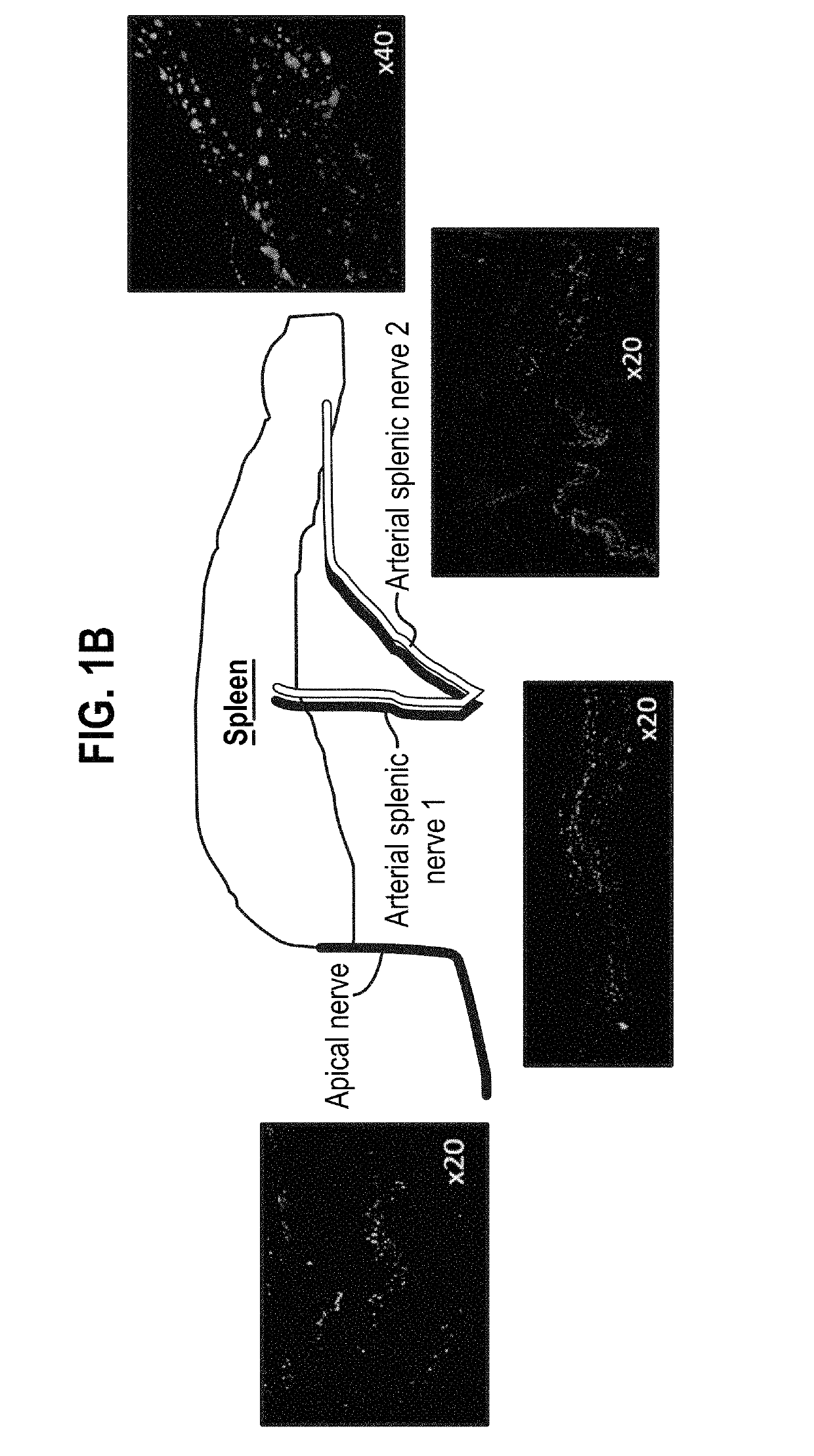 Treatment of inflammatory disorders