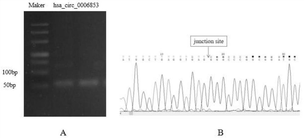 Plasma exosome circRNA marker for diagnosis and prognosis monitoring of gastric cancer and application of plasma exosome circRNA marker