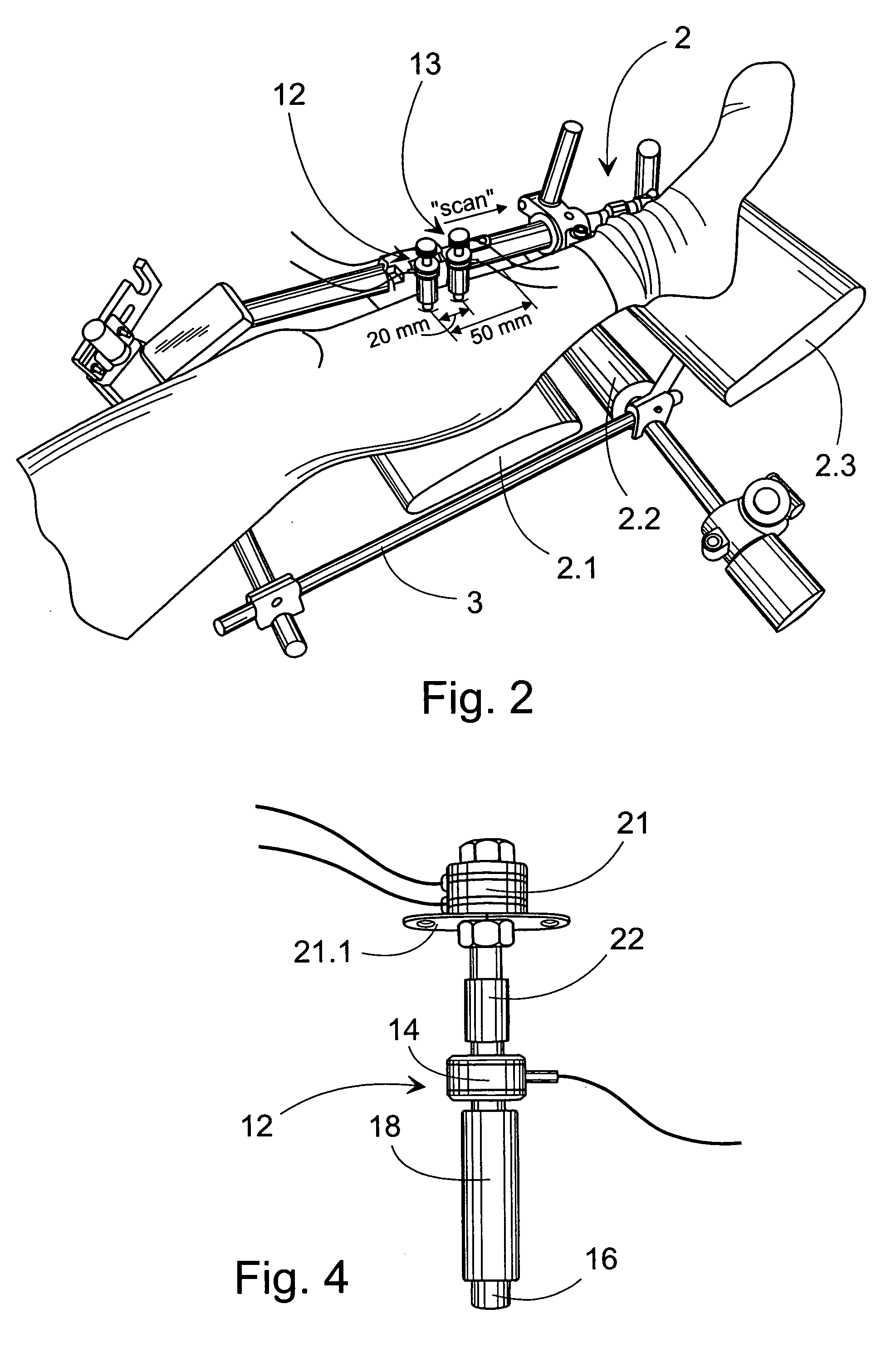 Method and device for the non-invasive assessement of bones