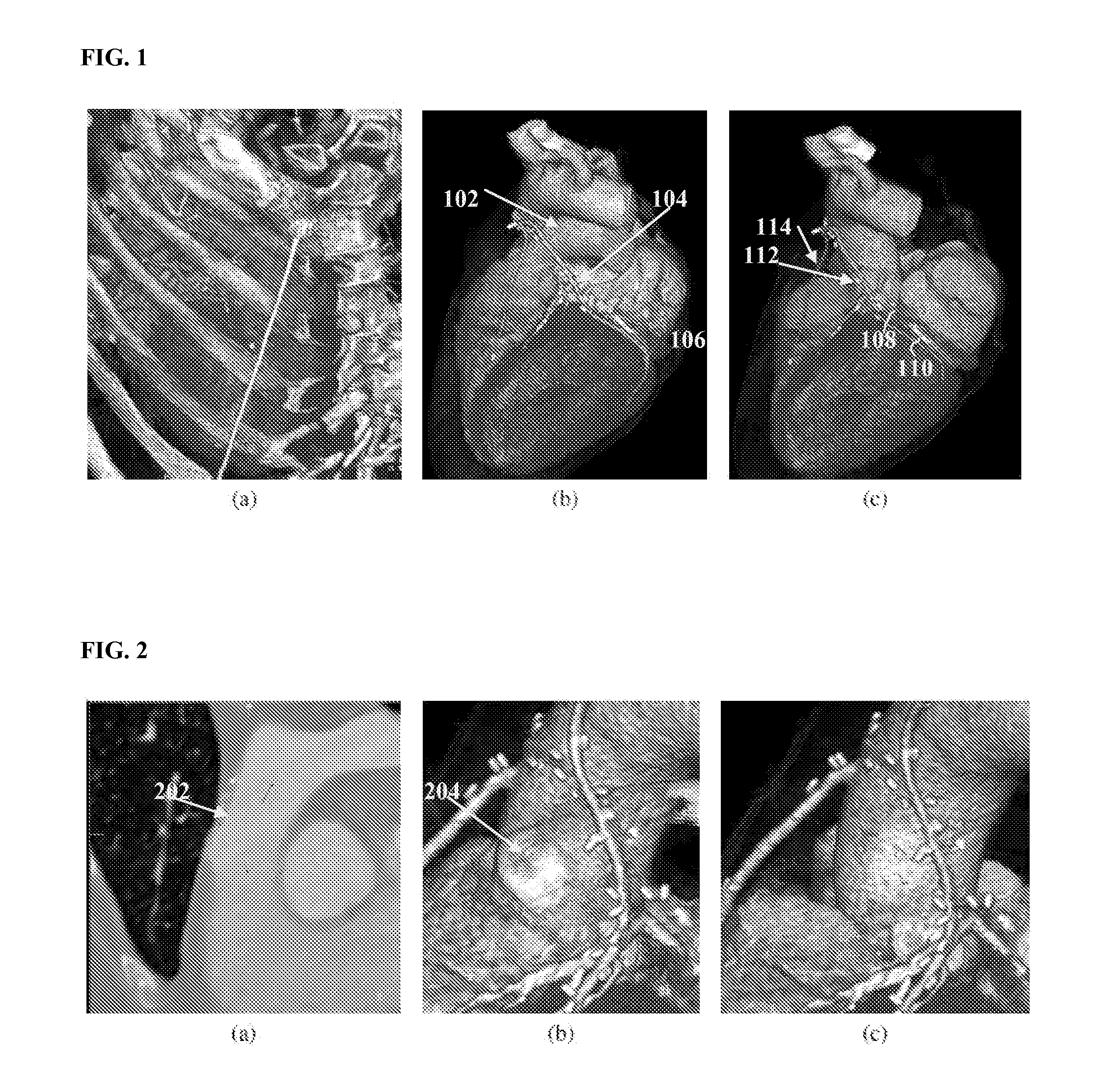 Method and System for Segmentation and Removal of Pulmonary Arteries, Veins, Left Atrial Appendage