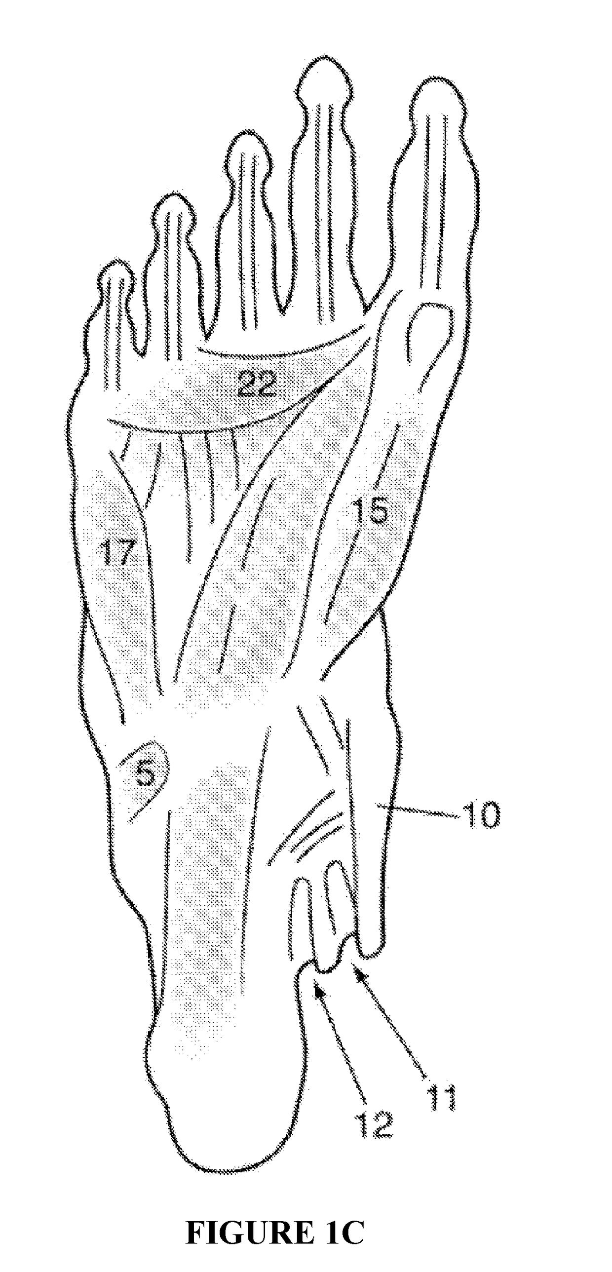 Method and apparatus for noninvasive inhibition of deep vein thrombosis