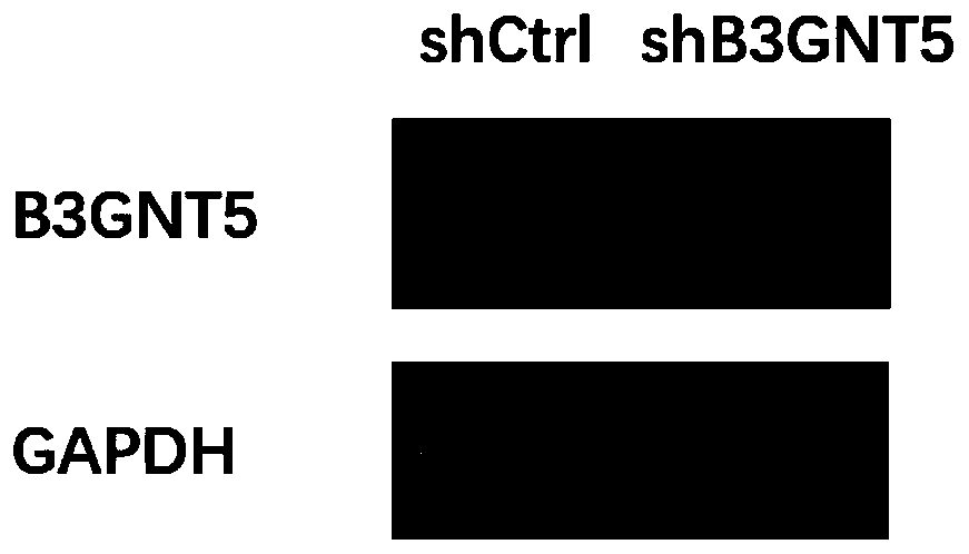 Application of human B3GNT5 gene and related product