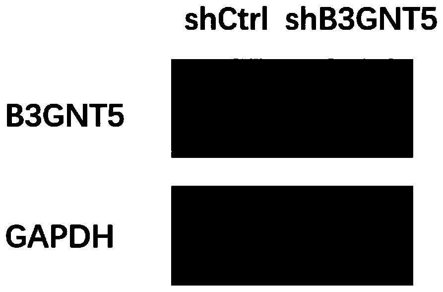 Application of human B3GNT5 gene and related product