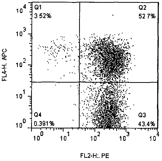 Exosome as well as preparation method and application thereof in preparing medicine for treating lung cancer