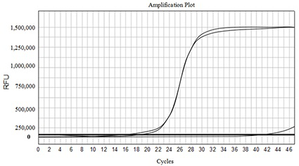 Novel coronavirus nucleic acid detection kit