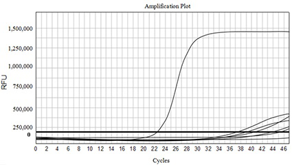 Novel coronavirus nucleic acid detection kit