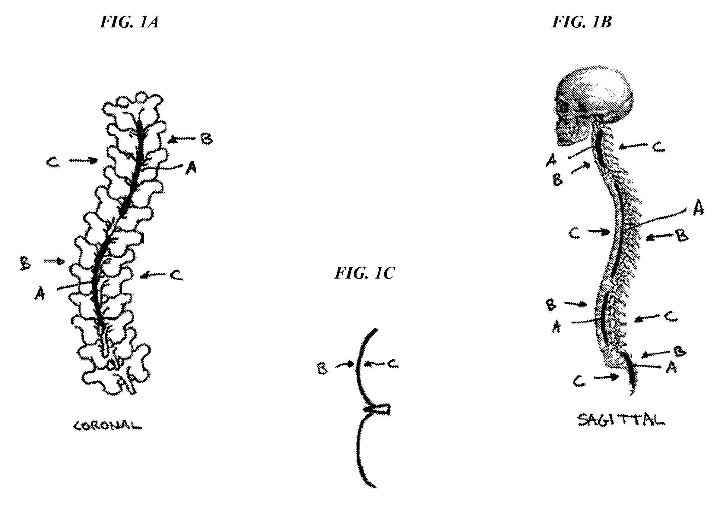 Methods and devices for correcting spinal deformities
