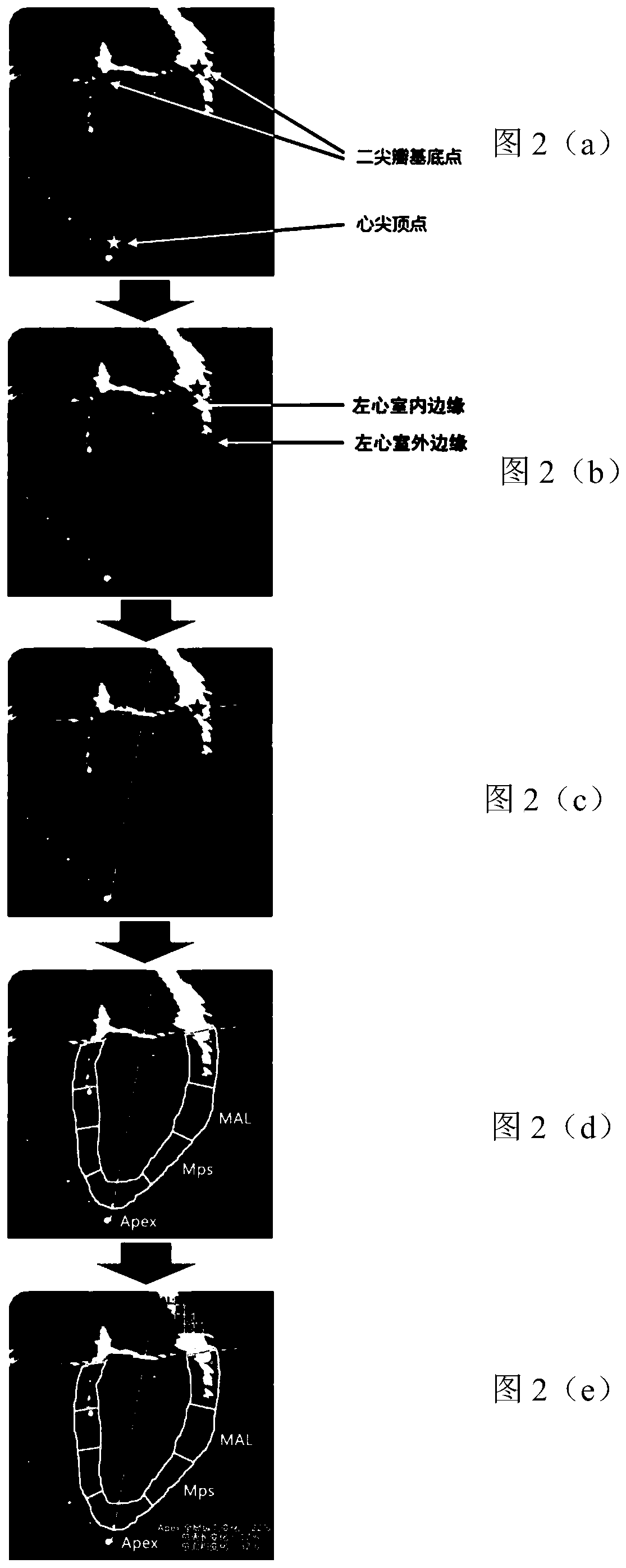 Cardiac medical image processing device, processing system and medium