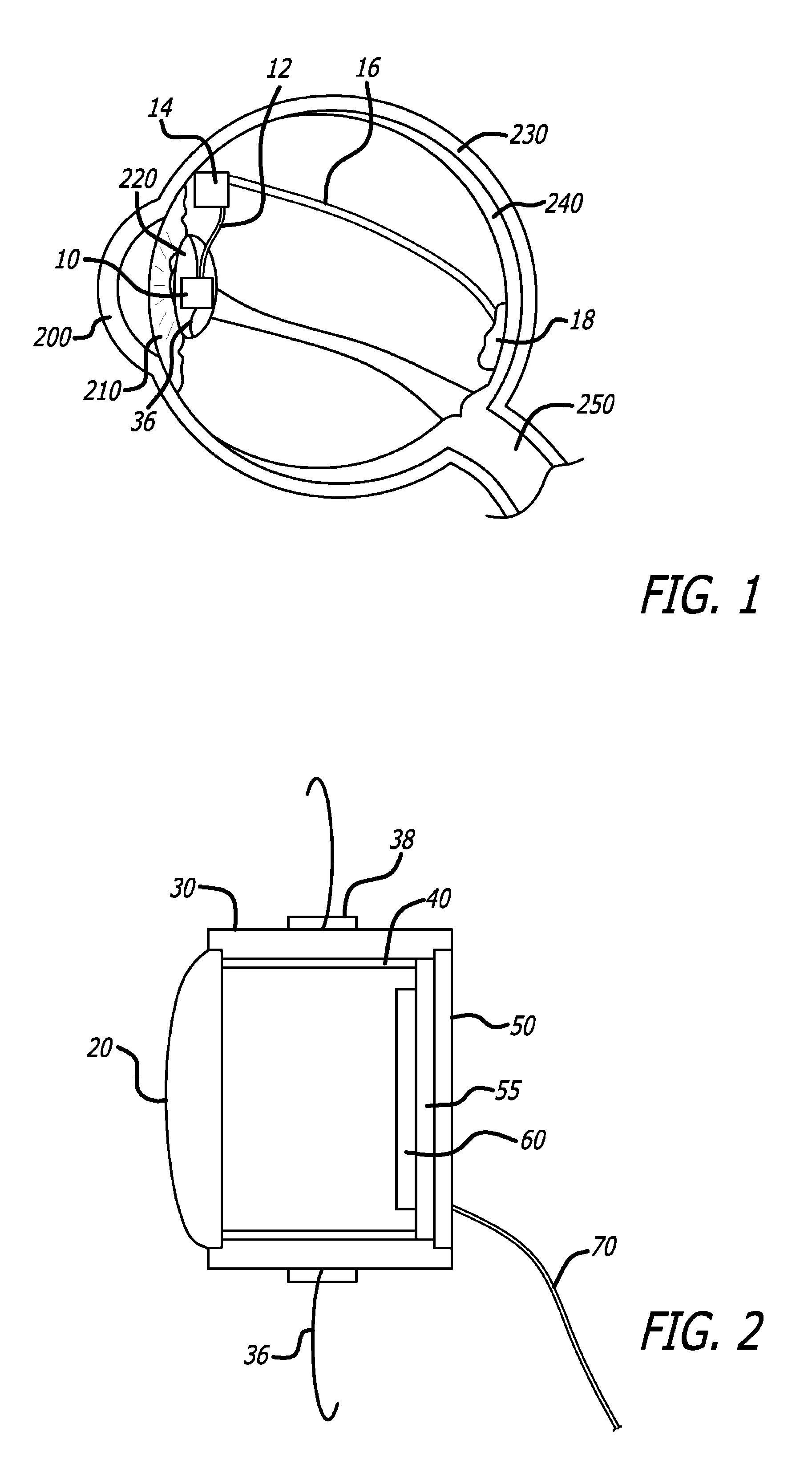 Intraocular camera for retinal prostheses