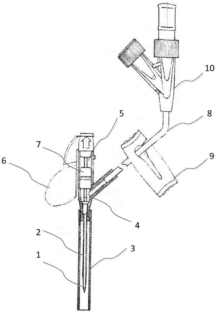 Anti-reflux intravenous indwelling needle