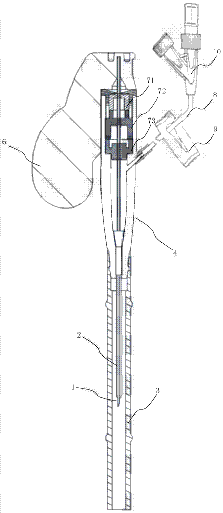 Anti-reflux intravenous indwelling needle