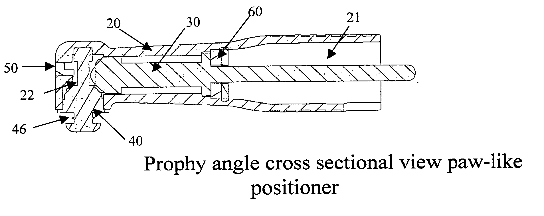 Disposable dental prophy angle with secure retention mechanism