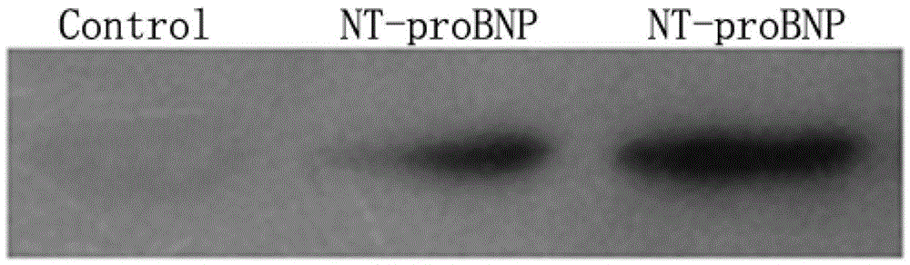 N-terminal B-cell epitope peptide of brain natriuretic peptide and its application