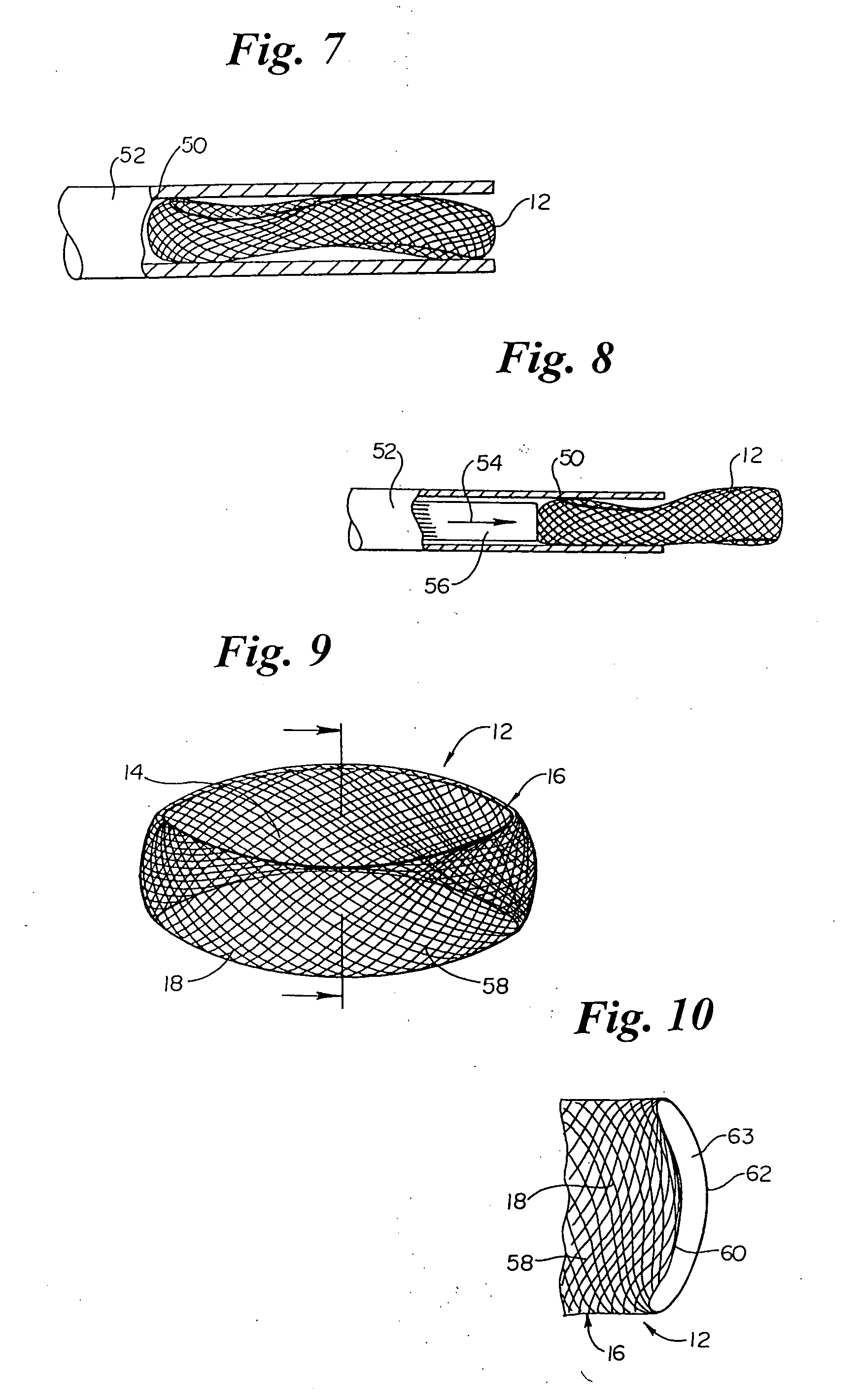 Annulus-reinforcing band