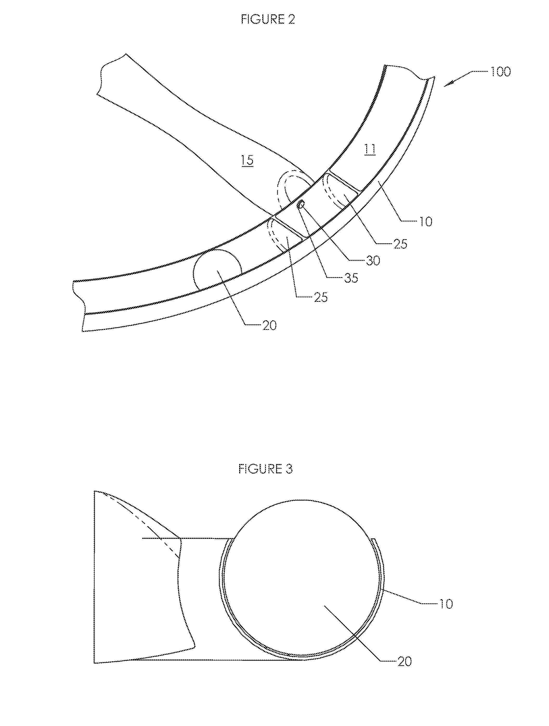 Exercise Device and Method of Use