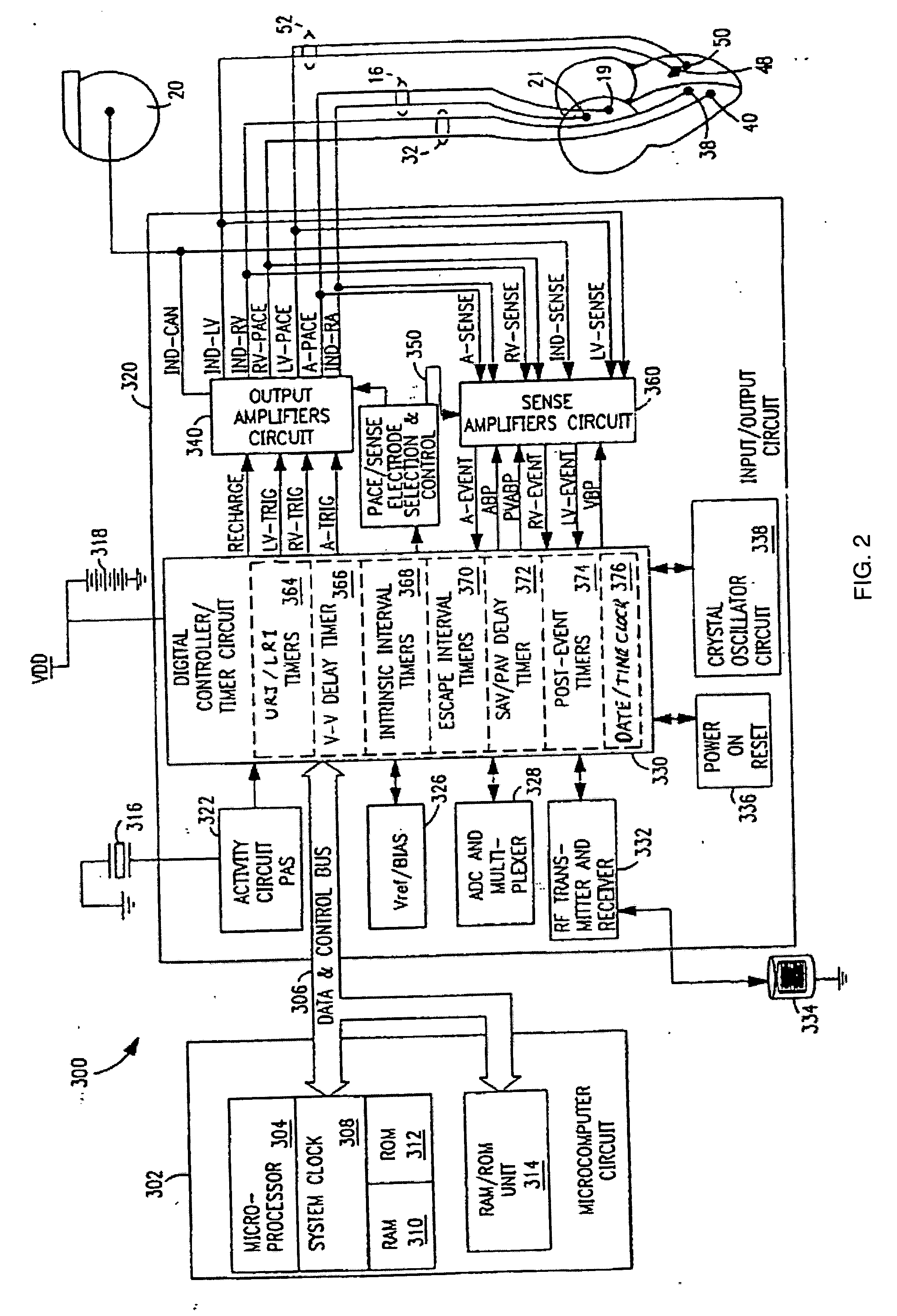 System and method for providing alternative pacing modality selection