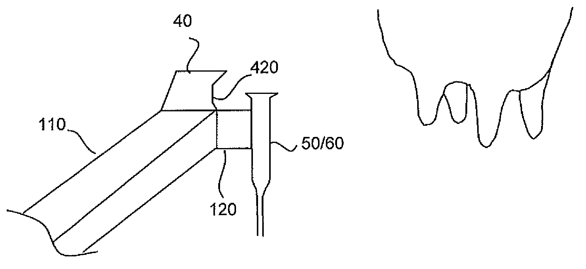 Method and apparatus for protecting an optical detection device from contamination