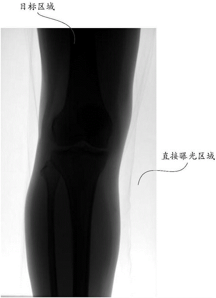 Image correction method and apparatus, and X-ray photographing device