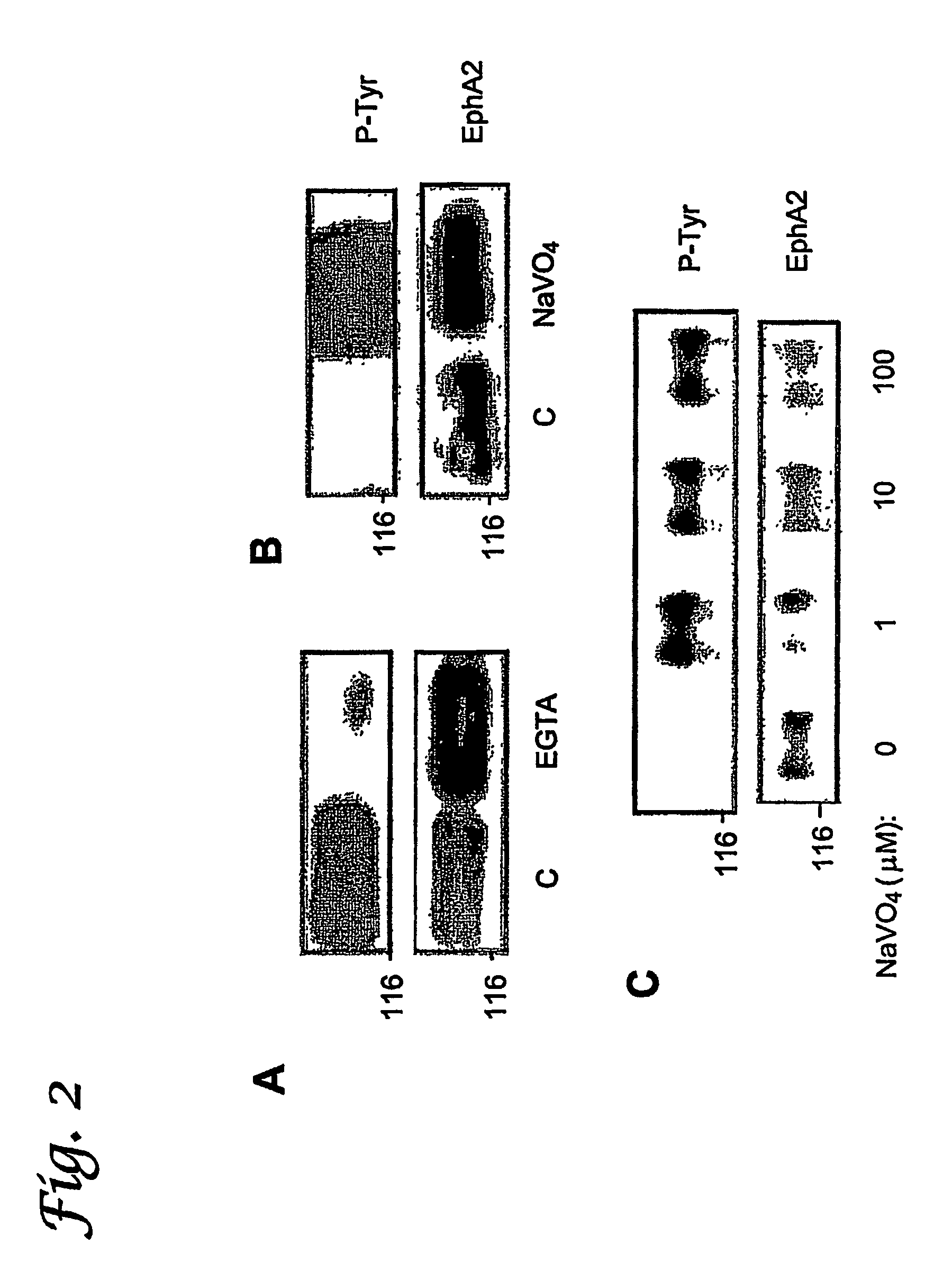 Low molecular weight protein tyrosine phosphatase (LMW-PTP) as a diagnostic and therapeutic target