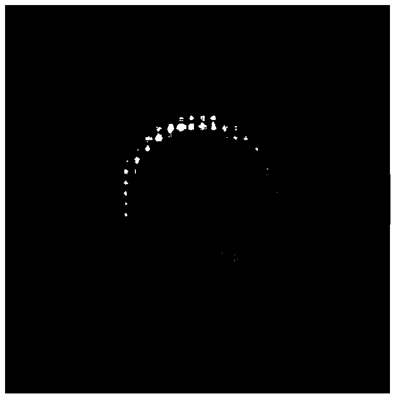 Antigen-antibody Reaction Determination Method Based on Microlens Imaging