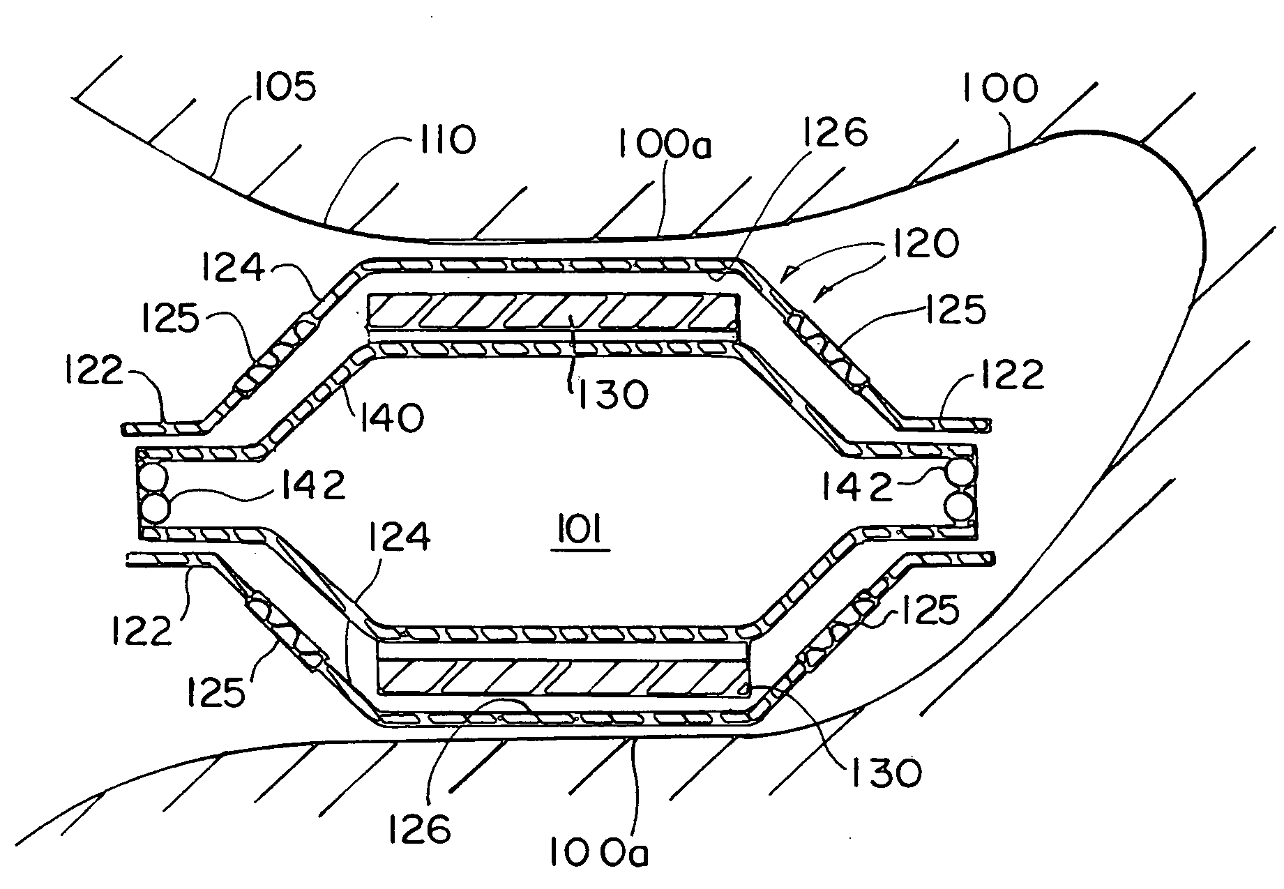 Expandable implant devices for filtering blood flow from atrial appendages