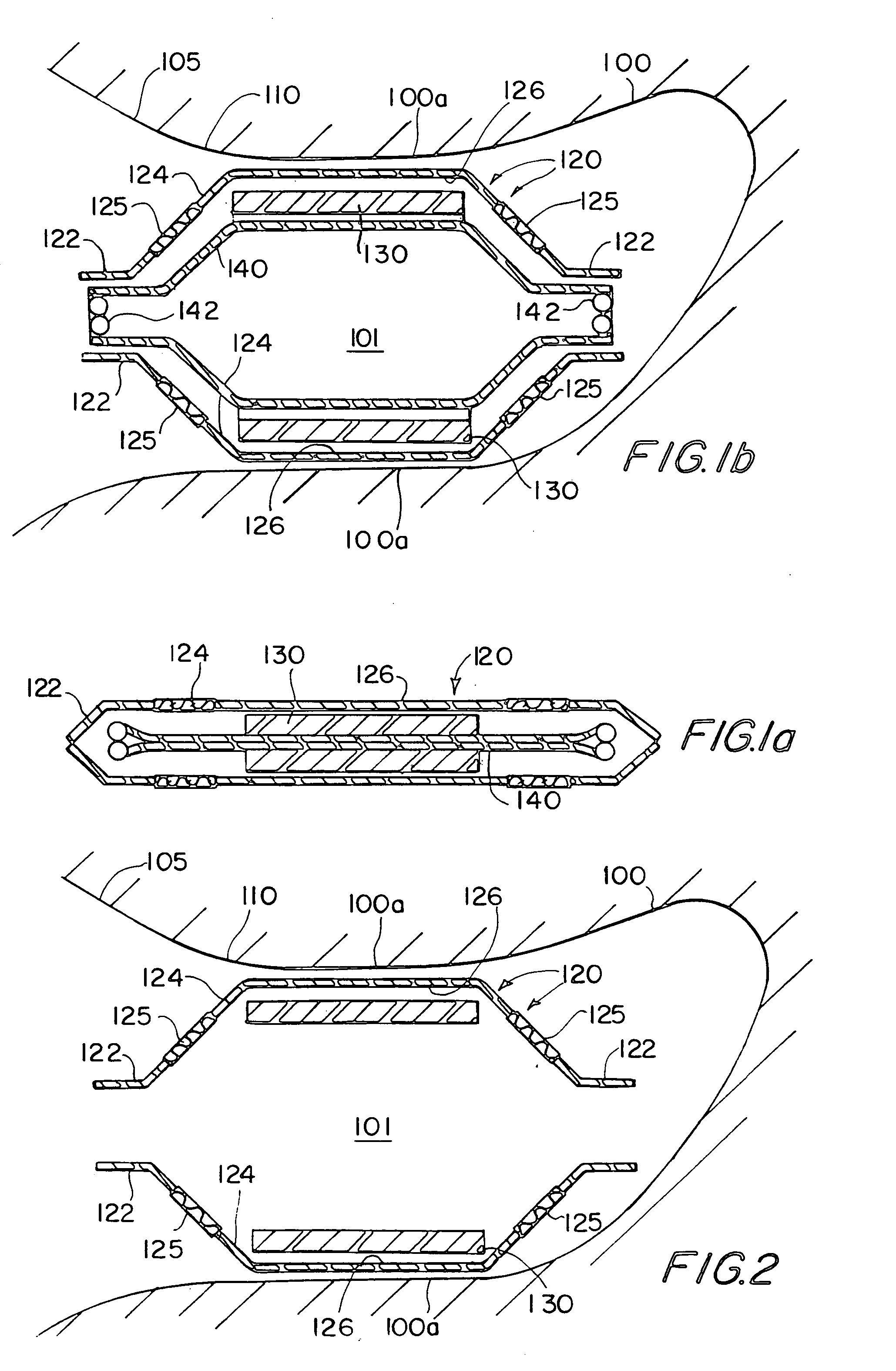 Expandable implant devices for filtering blood flow from atrial appendages