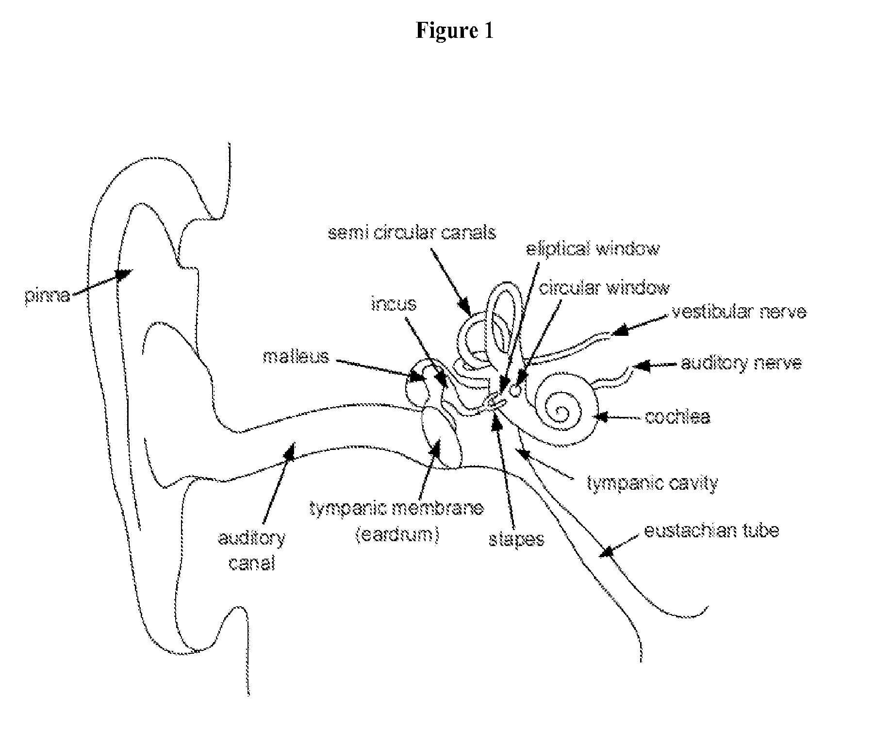 Treatment and/or Prevention of Inner Ear Conditions by Modulation of a Metabotropic Glutamate Receptor