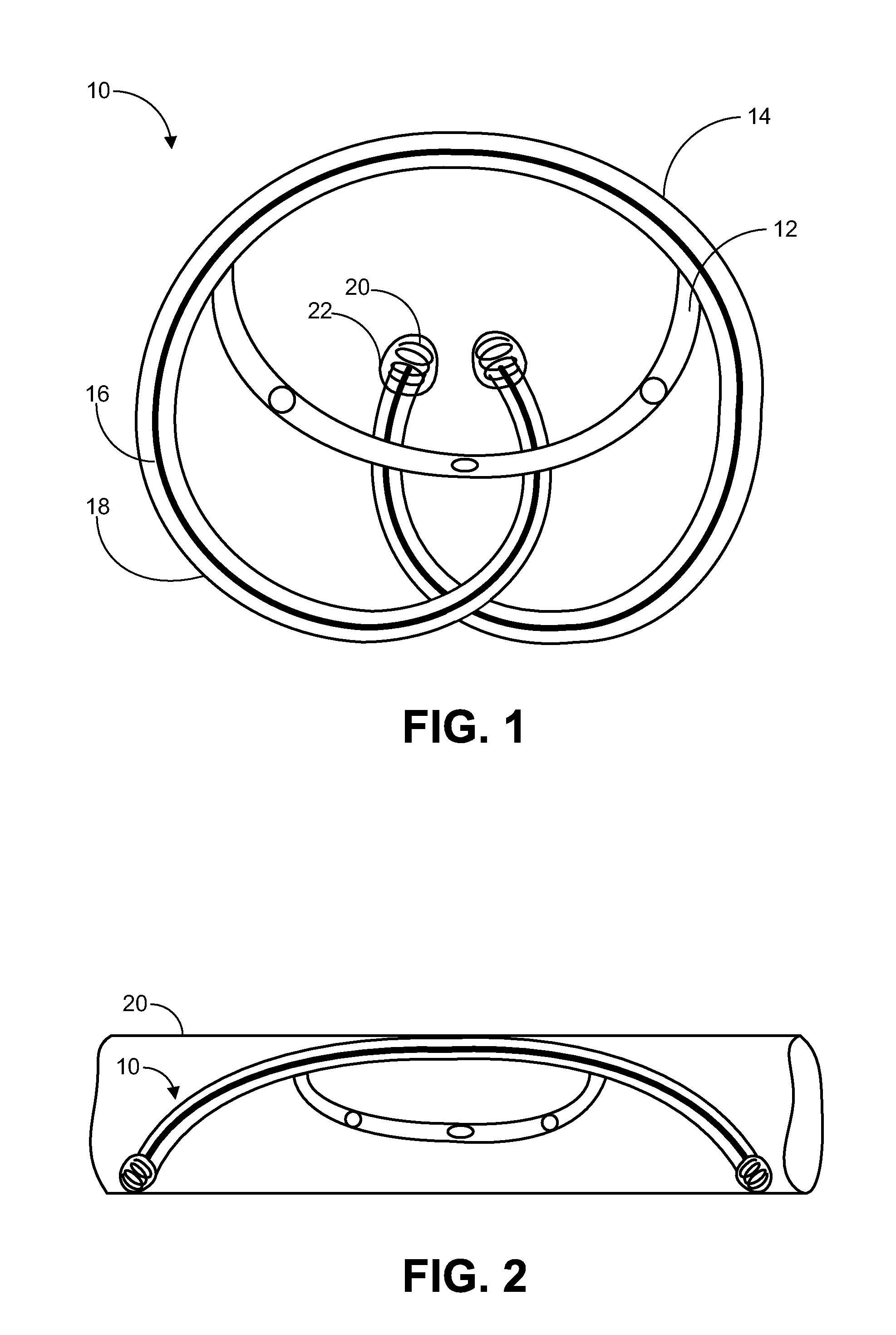 Implantable Drug Delivery Device and Methods for Treatment of the Bladder and Other Body Vesicles or Lumens