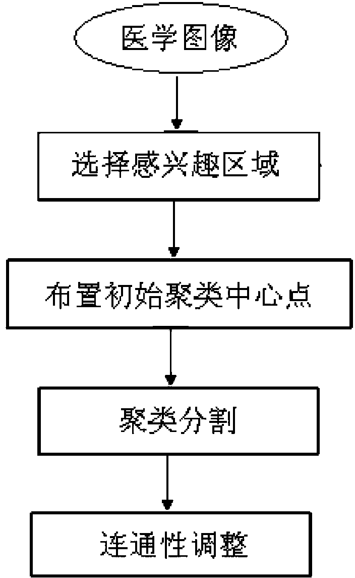 Medical image segmentation algorithm