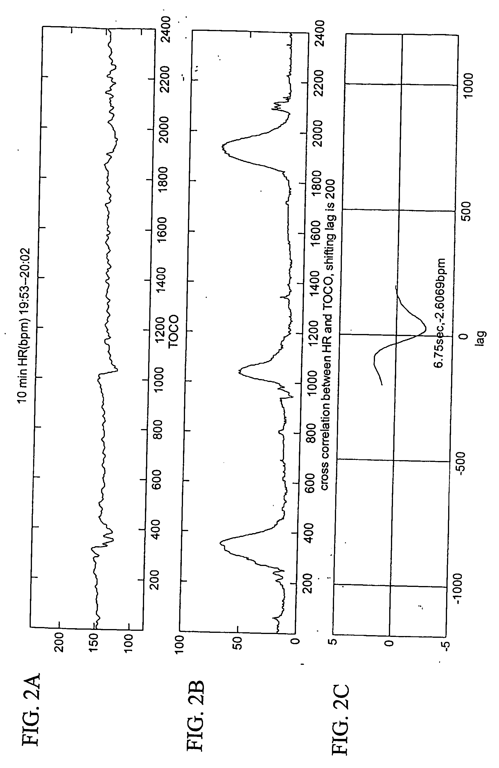 Quantitative fetal heart rate and cardiotocographic monitoring system and related method thereof