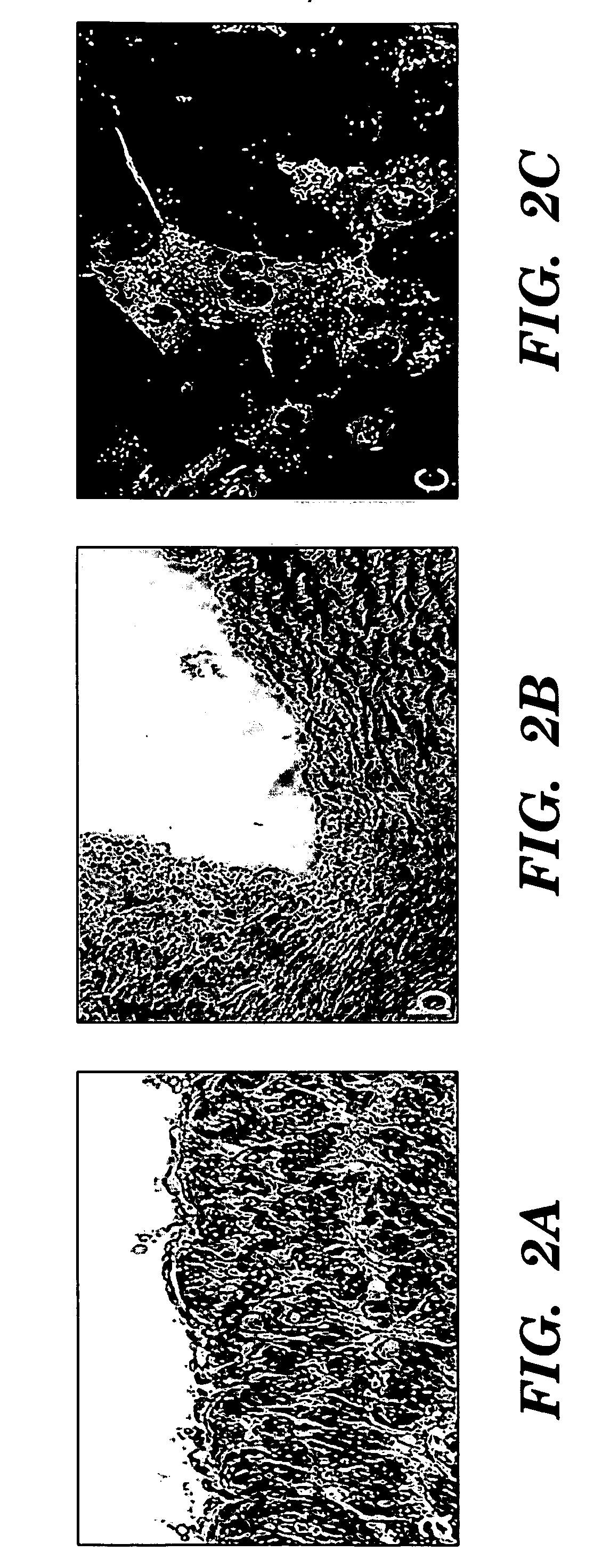 Method of isolating cells from umbilical cord