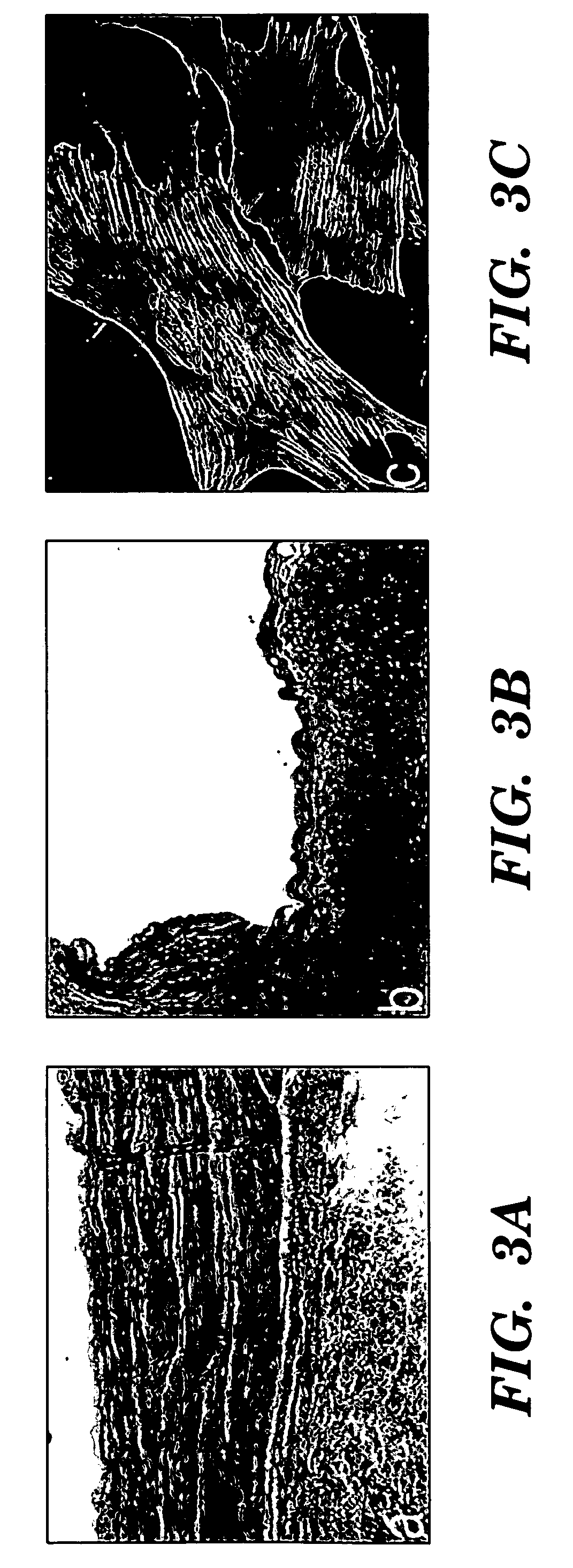 Method of isolating cells from umbilical cord