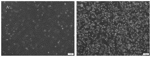 Recombinant Vero cell line capable of stably expressing porcine delta coronavirus-N protein and application of recombinant Vero cell line