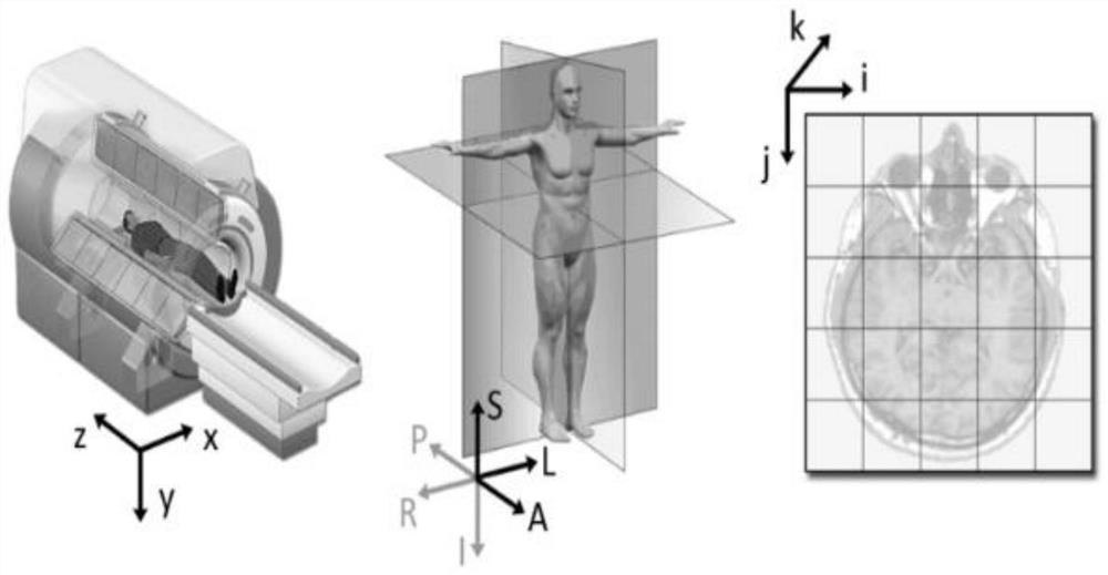 Method for fully automatically measuring lower sternum/xiphoid process in CT/MRI volume