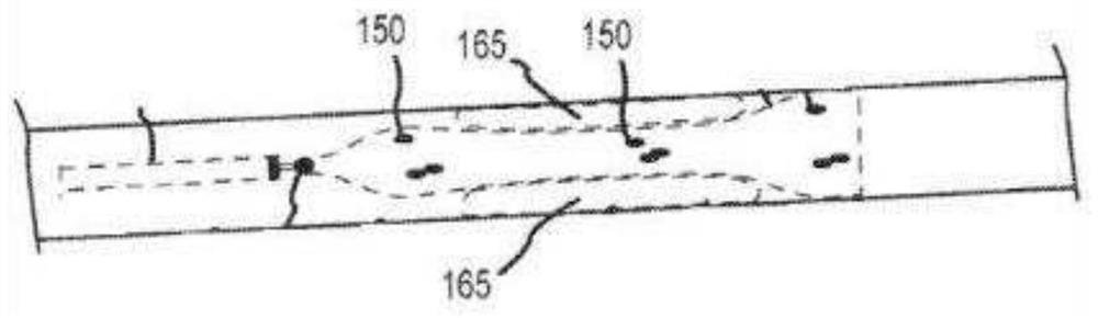 Developing structure, stent and thrombus removal system