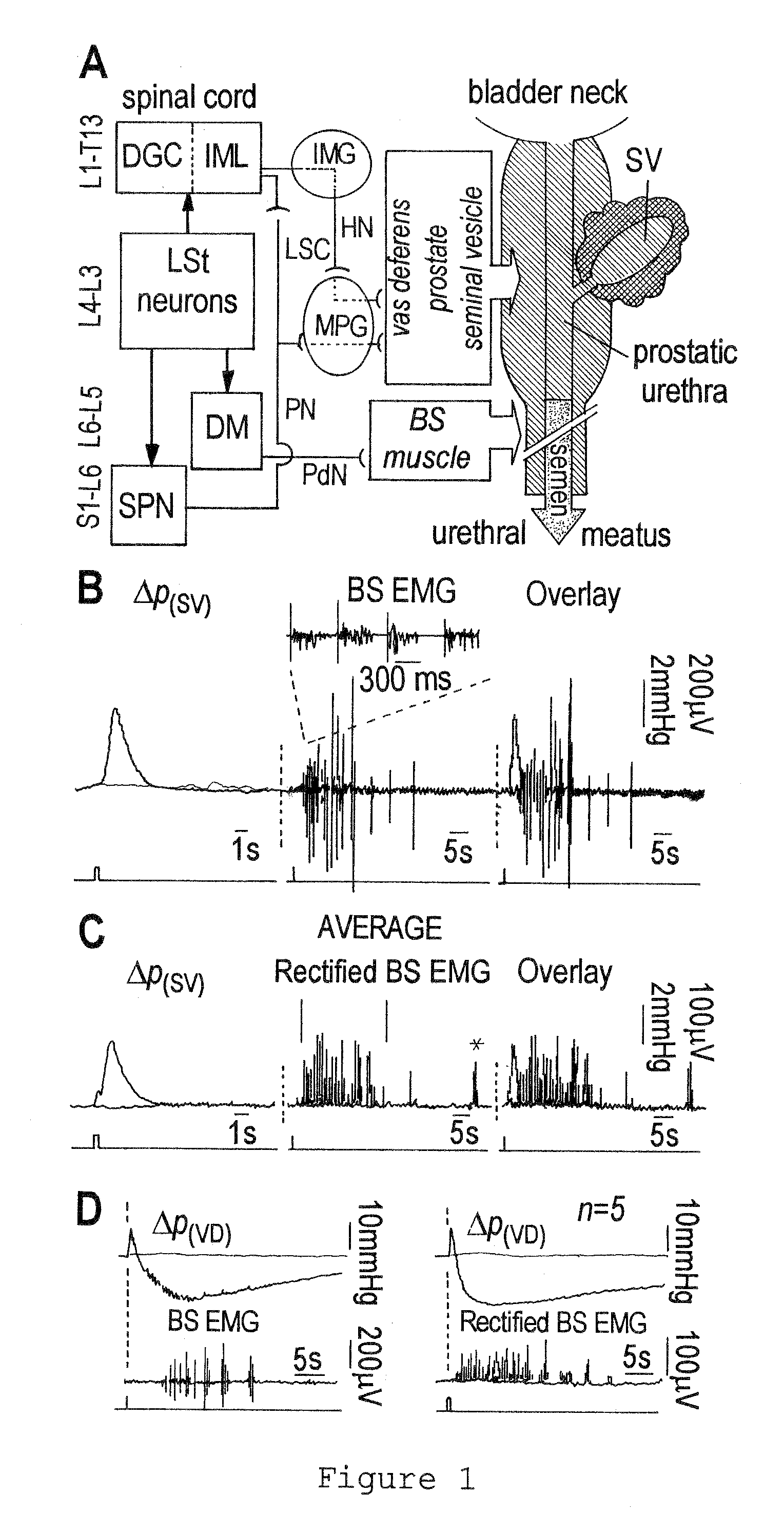 Method for restoring an ejaculatory failure