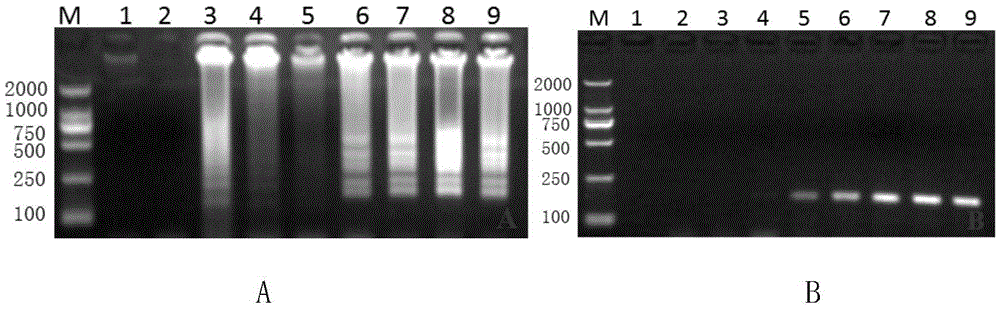 Application of Aspergillus fumigatus annexin anxC4 gene (anxC4 gene)