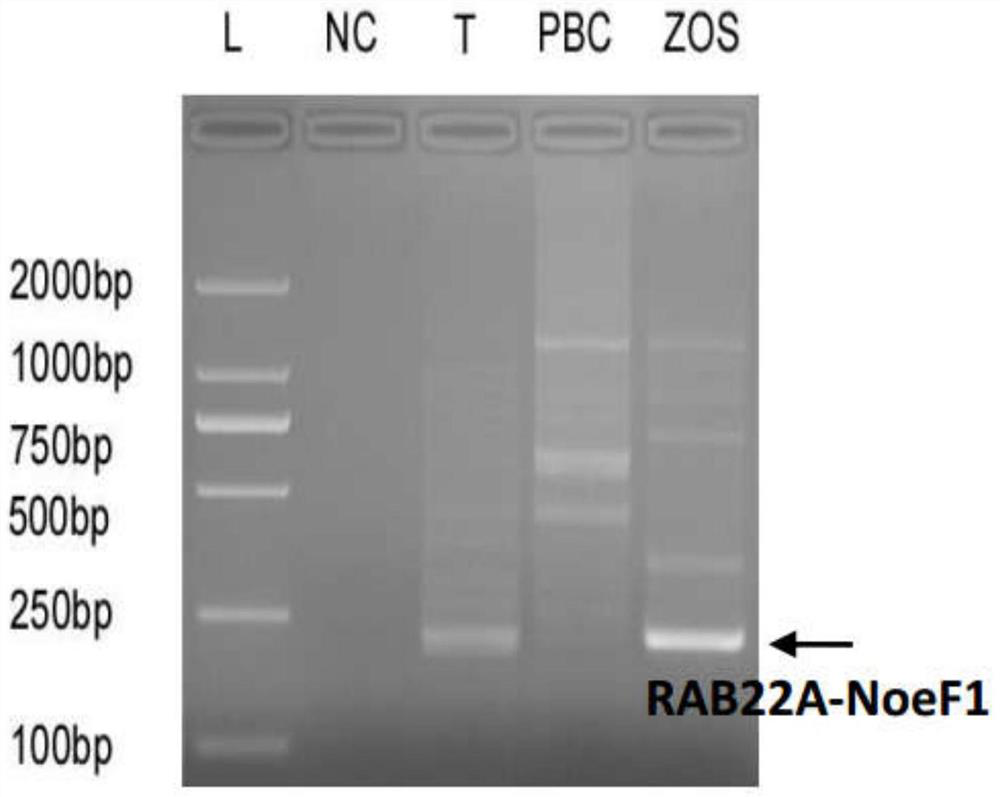 A kind of rab22a-noefs fusion gene line and application thereof for diagnosis and/or treatment of osteosarcoma