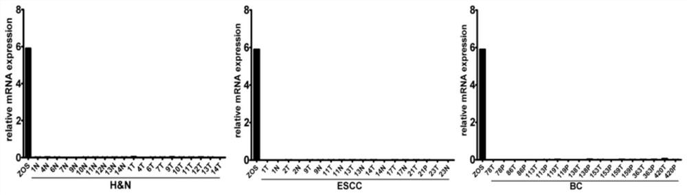 A kind of rab22a-noefs fusion gene line and application thereof for diagnosis and/or treatment of osteosarcoma