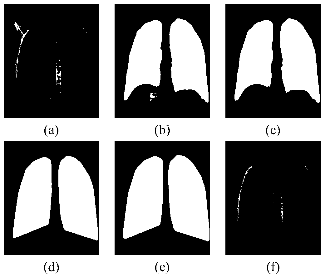 DR image pulmonary tuberculosis intelligent segmentation and detection method based on deep learning
