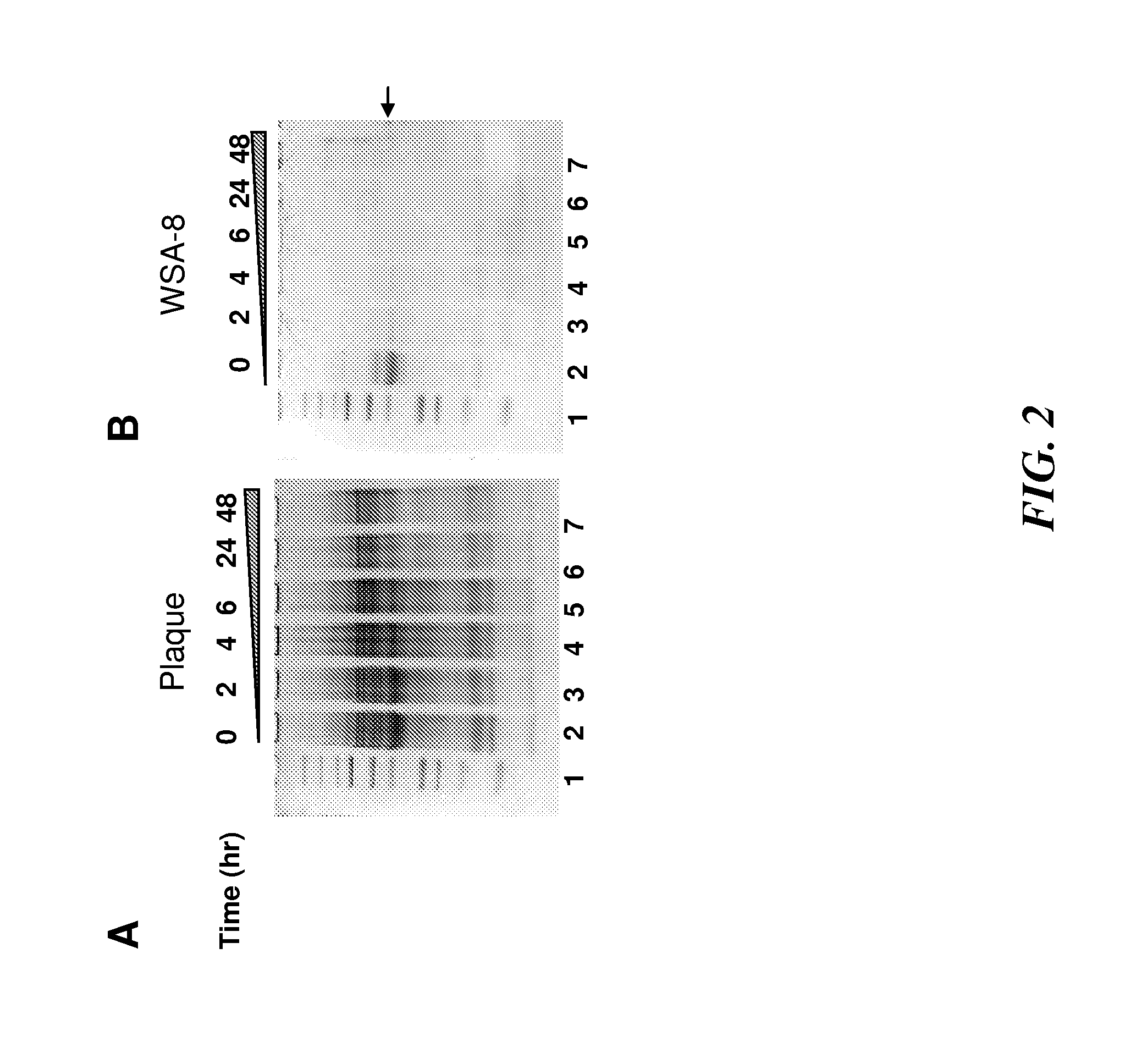 Rothia species glutamine endopeptidases and use thereof